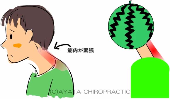 頭痛の原因　緊張型頭痛