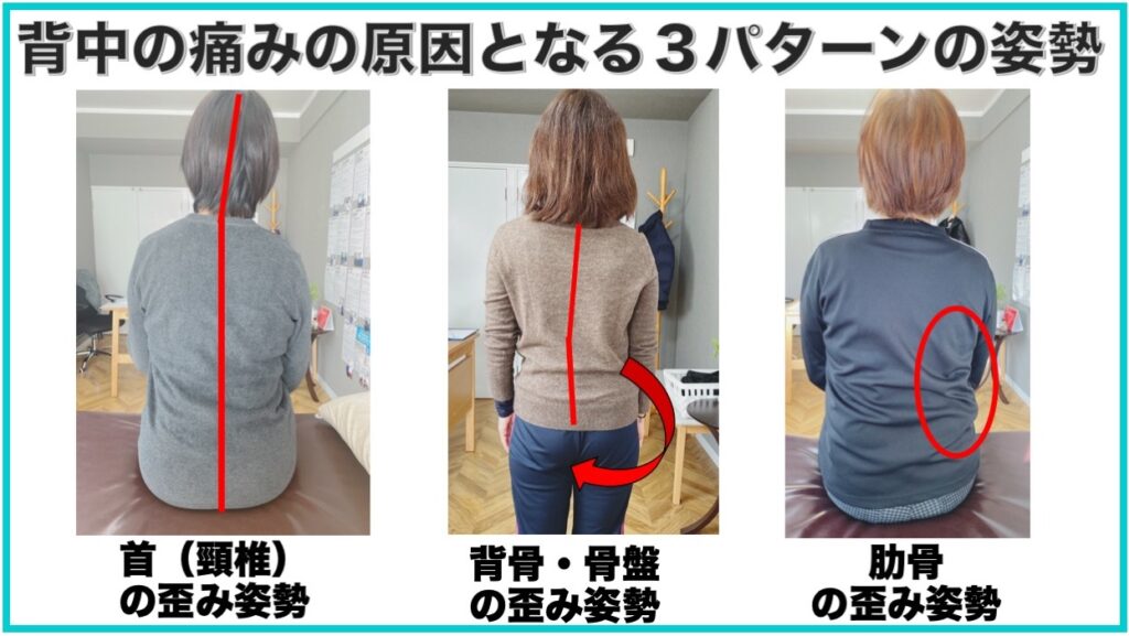 別府整体姿勢専門サロンゆのまち　背中の痛みの原因となる姿勢の３つのパターン