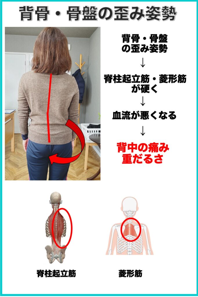 別府整体姿勢専門サロンゆのまち　背骨・骨盤の歪み姿勢と背中の痛みの関係性