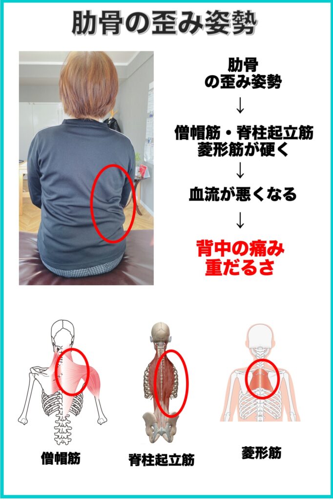 別府整体姿勢専門サロンゆのまち　肋骨の歪み姿勢と背中の痛みの関係性